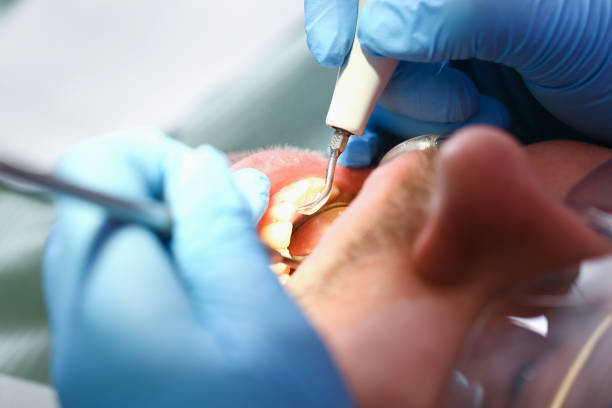 Best Emergency Denture Repair in Winston, OR