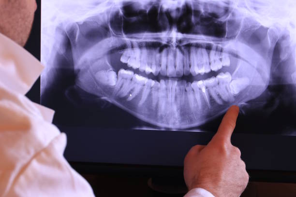Best Emergency Gum Treatment in Winston, OR