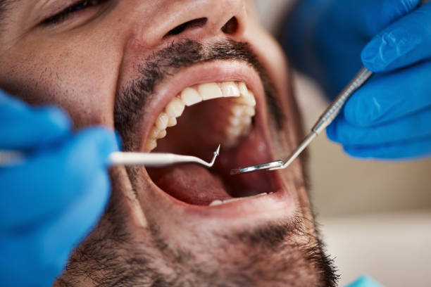 Best Urgent Care for Lost Fillings or Crowns in Winston, OR